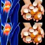 Eggshell Remedy for Knee and Bone Pain: A Natural Solution