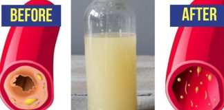 Only a Glass of This Juice Will Remove Clogged Arteries and Control Blood Pressure – Garlic, Lemon, and Apple Cider Vinegar