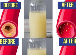 Only a Glass of This Juice Will Remove Clogged Arteries and Control Blood Pressure – Garlic, Lemon, and Apple Cider Vinegar