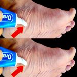 Stop Spending Money at the Pharmacy! Put Toothpaste on Your Feet (Did You Know That?)