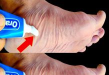 Stop Spending Money at the Pharmacy! Put Toothpaste on Your Feet (Did You Know That?)