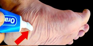 Stop Spending Money at the Pharmacy! Put Toothpaste on Your Feet (Did You Know That?)