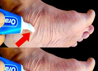 Stop Spending Money at the Pharmacy! Put Toothpaste on Your Feet (Did You Know That?)