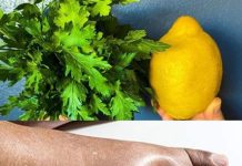Natural Diuretics Using Parsley and Lemon to Combat Water Retention