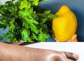 Natural Diuretics Using Parsley and Lemon to Combat Water Retention