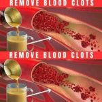 Boost your Circulatory System with a Turmeric and Ginger Drink