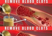 Boost your Circulatory System with a Turmeric and Ginger Drink