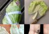 Amazing Remedy for Varicose Veins: Cabbage Leaves