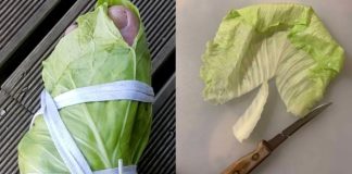 Amazing Remedy for Varicose Veins: Cabbage Leaves