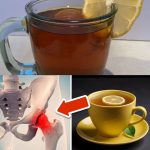 Drink a Cup Daily and Your Hip Osteoarthritis Will Improve Significantly: The Incredible Power of Lemon Tea