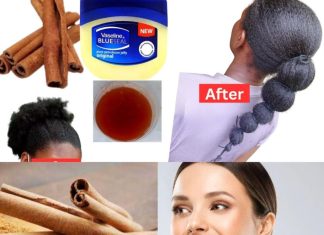 Mix Vaseline & Cinnamon for Powerful Hair Growth | Healthy, Natural Hair