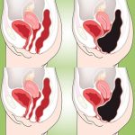 How to Cleanse Your Colon Naturally at Home