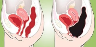 How to Cleanse Your Colon Naturally at Home