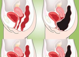 How to Cleanse Your Colon Naturally at Home