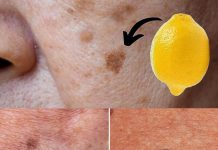 Lemon Removes Age Spots: Just Do This!