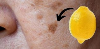 Lemon Removes Age Spots: Just Do This!