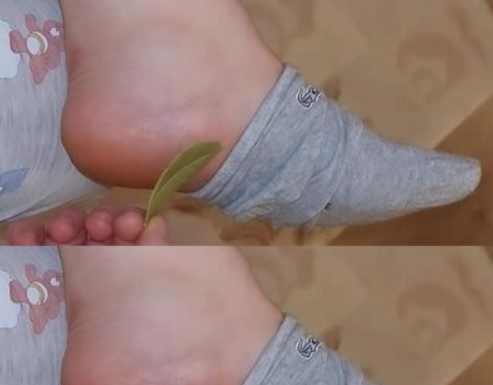 Wake Up Refreshed and Pain-Free with Bay Leaves