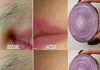 Remove Unwanted Facial Hair Permanently with Onion: A Quick and Natural Remedy