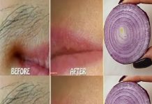 Remove Unwanted Facial Hair Permanently with Onion: A Quick and Natural Remedy