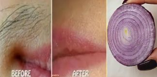 Remove Unwanted Facial Hair Permanently with Onion: A Quick and Natural Remedy
