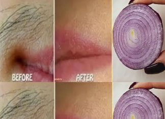 Remove Unwanted Facial Hair Permanently with Onion: A Quick and Natural Remedy