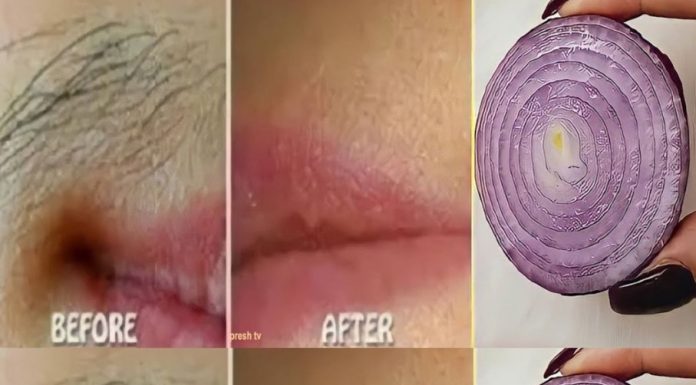 Remove Unwanted Facial Hair Permanently with Onion: A Quick and Natural Remedy