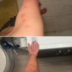 I have no idea what these are does anyone know what ive been bitten by please ? I have two on the other side aswell