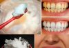 How to Naturally Whiten Your Teeth at Home in Just 3 Minutes