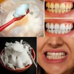 How to Naturally Whiten Your Teeth at Home in Just 3 Minutes