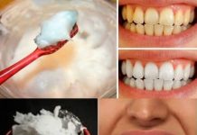 How to Naturally Whiten Your Teeth at Home in Just 3 Minutes