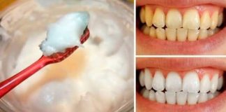 How to Naturally Whiten Your Teeth at Home in Just 3 Minutes
