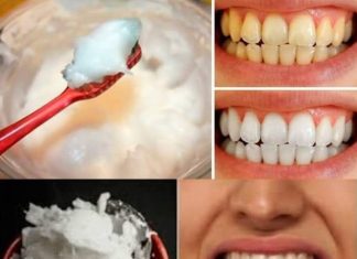 How to Naturally Whiten Your Teeth at Home in Just 3 Minutes