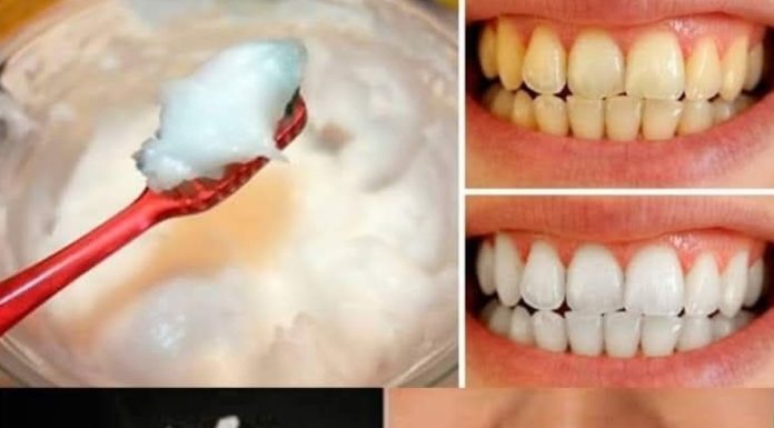 How to Naturally Whiten Your Teeth at Home in Just 3 Minutes