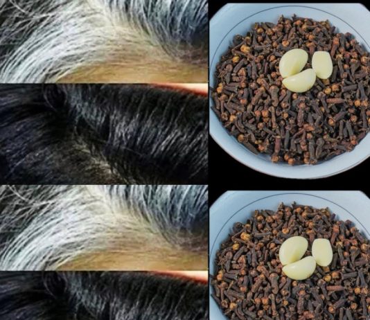 Natural Hair Darkening Remedy: Cloves and Garlic