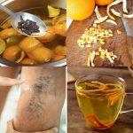 Orange Peel Tea: A Natural Remedy for Varicose Veins, Diabetes, and Hypertension