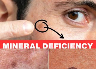 Your Age Spots Are Caused by a Deficit in Selenium: Why You Need It