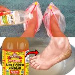 I Put Vinegar on My Feet, and You Won’t Believe What Happened!