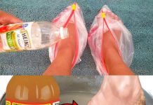 I Put Vinegar on My Feet, and You Won’t Believe What Happened!