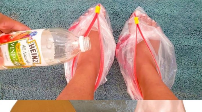 I Put Vinegar on My Feet, and You Won’t Believe What Happened!