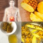 5 Ways to Use Pineapple as a Medicine