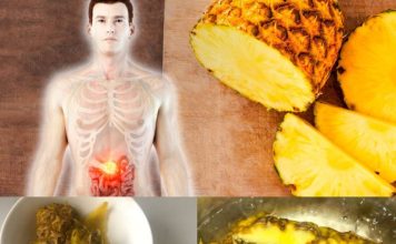 5 Ways to Use Pineapple as a Medicine