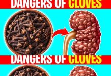 Health Considerations: When to Avoid Cloves