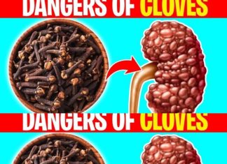 Health Considerations: When to Avoid Cloves