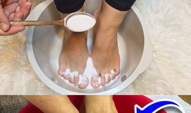 I Put Baking Soda on My Feet, and Look What Happened!