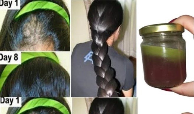 The Indian Secret to Rapid Hair Growth and Combating Baldness