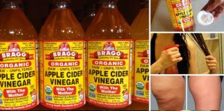 7 Surprising Beauty Benefits of Apple Cider Vinegar