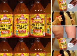 7 Surprising Beauty Benefits of Apple Cider Vinegar