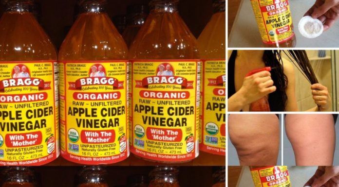 7 Surprising Beauty Benefits of Apple Cider Vinegar