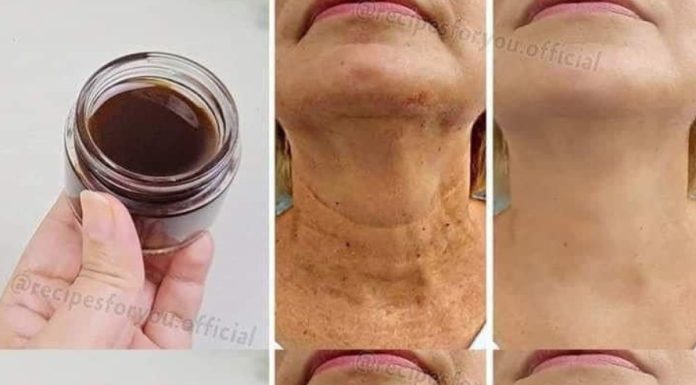 A Miracle Oil for Anti-Aging: Coffee Oil That Reduces Wrinkles More Effectively Than Botox!