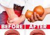 Onion Tea: A Natural Boost for Bladder and Prostate Health
